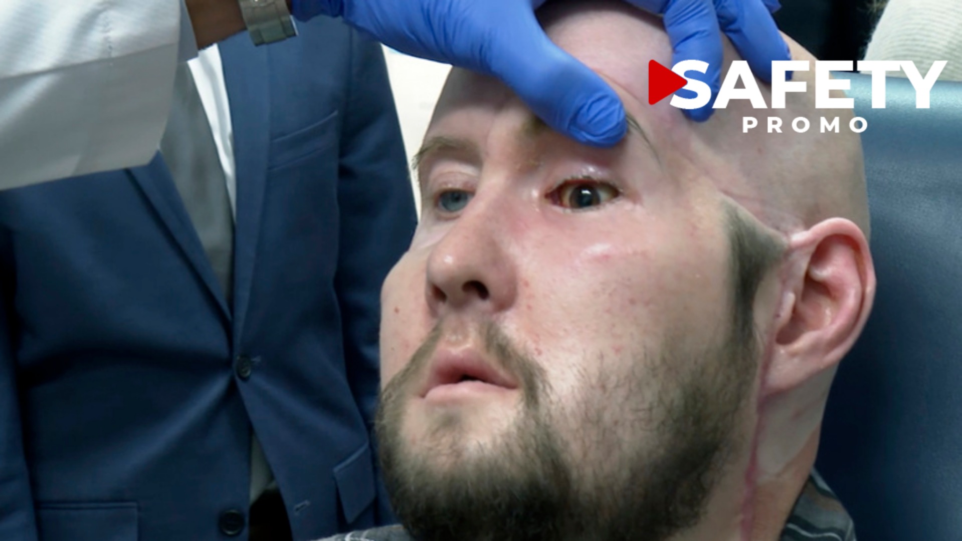 États-Unis : un patient a reçu la greffe d’un œil complet, une première historique